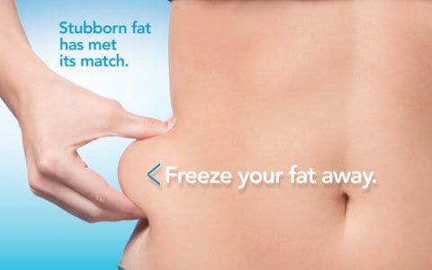 Hips treatment Ryton on Dunsmore From Lipo Sculpt