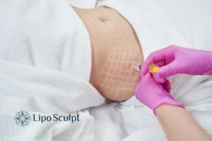 Do you want to know how long Aqualyx Ryton on Dunsmore results last?