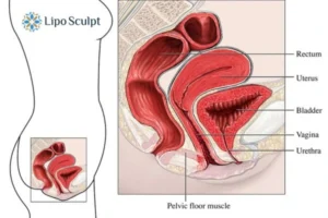 How EM Chair treatment Ryton on Dunsmore can help Leaky bladder issues. Read more now!