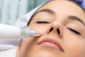 Best Actinic Keratoses Removal 3 Actinic keratoses Ryton on Dunsmore solutions - book in today!